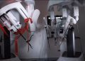 Da Vinci Single Port Robotic Surgery